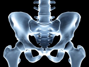 Avoid Hip Replacement
